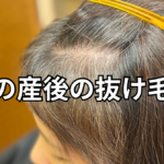 女性の産後の抜け毛問題〜必ず治るから安心してね〜